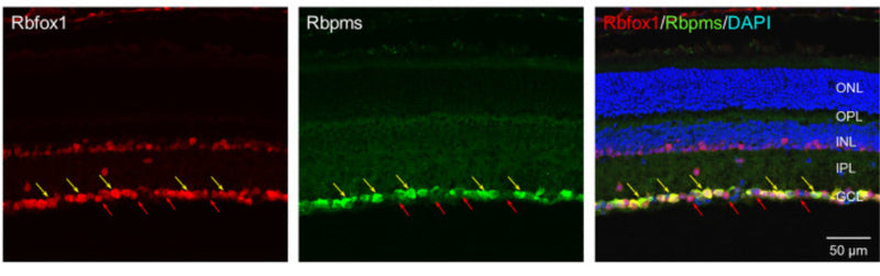 Immunostaining of mouse retina showing labeling of Rbfox1 (red), RBPMS (green), and DAPI(blue). Image from publication CC-BY-4.0. PMID: 35730583