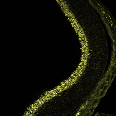 Immunolabeling of E18.5 mouse retina specifically labeling RBPMS (1832-RBPMS, 1:500). Image produced by Marley Blommers and kindly provided by Angelo Iulianella, Dalhousie University. More information can be found in the publication “Retinal neuroblast migration and ganglion cell layer organization require the cytoskeletal-interacting protein Mllt11.” Developmental Dynamics, PMID: 36131367.