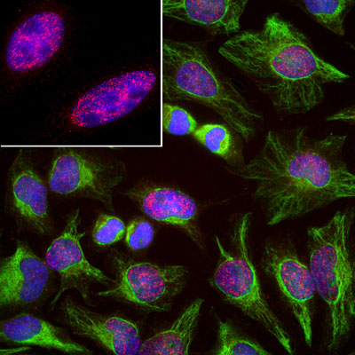 Immunoflourescence of HeLa cells labeled with anti-SAP49 (cat. 1900-SAP, red, 1:1000) and anti-vimentin (cat. 2105-VIM, green, 1:10,000). The blue is DAPI staining nuclear DNA.