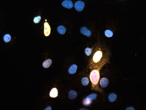 Immunofluoresence of FLAG-tagged SOX2 transfected COS cells showing SOX2 staining in red (cat. 1907-SOX2, 1:20) and FLAG staining in green, causing positive transfected cells to appear yellow. DNA is stained blue with DAPI.