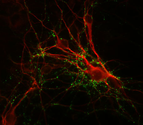 Immunostaining of cultured mouse caudate neurons showing punctate distribution of synapsin (cat. 1925-SYNP, 1:1000, green) and MAP (red). Cells and photo courtesy of QBMCellScience.