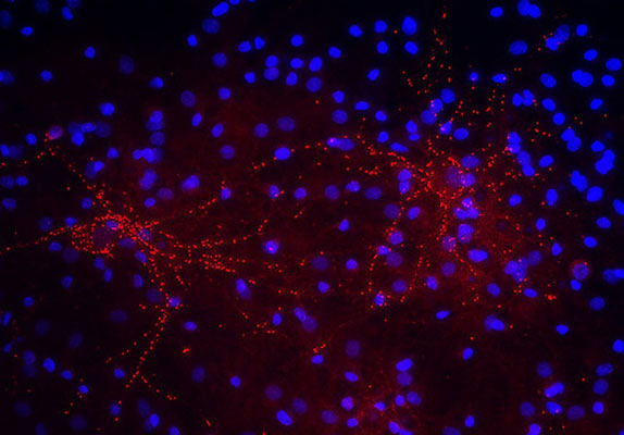 Immunostaining of 40DIV cultured rat cortical neurons showing punctate labeling of synaptophysin (cat. 1950-SNT2, red, 1:100). The blue is staining nuclear DNA. Cells and photo courtesy of QBMCellScience.