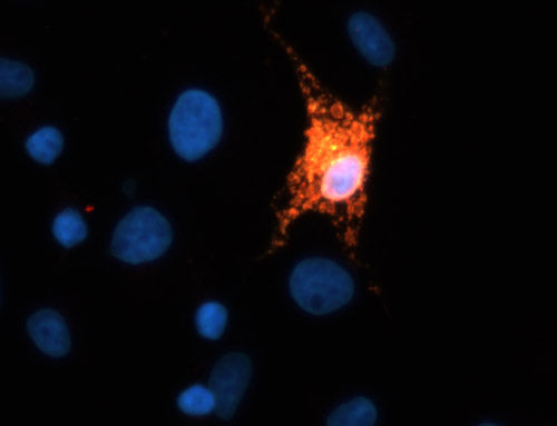 Immunofluoresence of FLAG-tagged TREM2 transfected COS cells showing TREM2 (cat. 2006-TREM2, 1:150) staining in red and FLAG staining in green causing positive transfected cells to appear yellow. DNA is stained blue with DAPI.