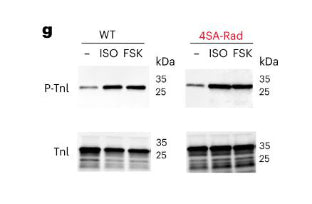 Western blots showing specific labeling of S23/S24 TnI, cat. p2010-2324 (upper) and TnI; cat. 2010-TnI (lower) in protein lysates of mouse cardiomyocytes. Image from publication CC-BY-4.0. PMID: 36424916