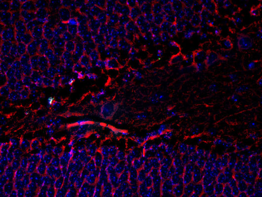 Immunostaining of mouse dentate gyrus showing beta III tubulin (red, 1:1000). The blue is staining nuclei. Photo courtesy of Robert Wine. 