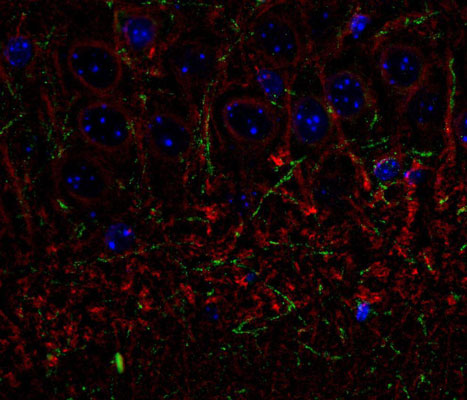 Immunolabelling of the CA3 subfield of mouse hippocampus labeling β-III tubulin(cat. 2020-TUB, 1:1000, red) and CNP (cat. 325-CNP , green, 1:500). The blue is DAPI staining DNA. Photo courtesy of Rob Wine.