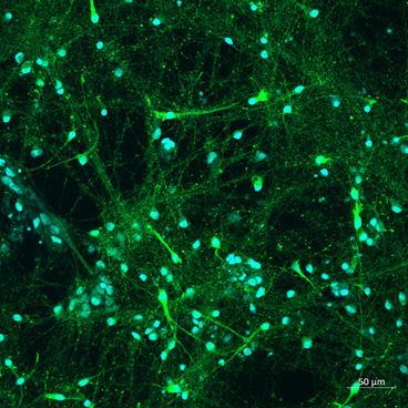 Immunofluorescence of human iPSC-derived dopaminergic neurons labeled with anti-tyrosine hydroxylase (cat.  2025-THRAB, green, 1:500). The blue stain is DAPI. Before labeling, cells were fixed with 4% PFA and permeabilized with 0.1 to 0.3 % Triton X. This image is kindly provided by Aurelie de Rus Jacquet, Howard Hughes Medical Institute, Janelia Research Campus.