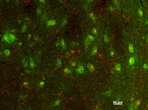 Immunofluorescence of human midbrain neuronal cultures showing TH positive neurons in green (cat. 2026-LNC1).