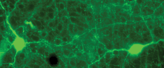 Immunostaining of rabbit retina showing specific labeling of tyrosine hydroxylase in green.