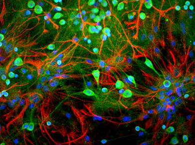 Immunostaining of mixed neuron/glial cultures stained with anti-UCHL1 antibody (cat. 2061-UCHL1, green, 1:500) and rabbit anti-GFAP antibody ( cat. 620-GFAP , red, 1:1000). The blue stains nuclear DNA. The anti-UCHL1 stains strongly the cell body and dendrites of neurons, while anti-GFAP specifically labels astrocytes.