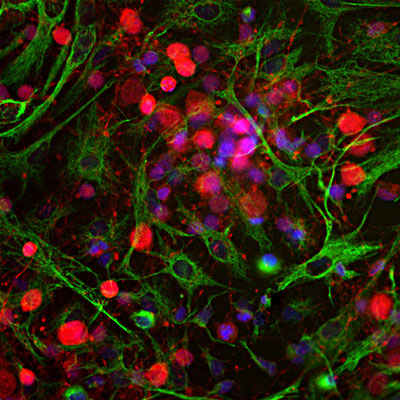 Immunostaining of E20 rat cortical neuron and glial culture stained with anti-UCHL1 antibody (cat. 2061-UCHL1, red, 1:500) and rabbit anti-vimentin antibody (green). The blue is DAPI staining nuclear DNA. The anti-UCHL1 stains strongly the cell body and dendrites of neurons, while anti-vimentin specifically stains intermediate filaments in fibroblasts and glia cells.