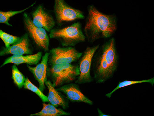 Immunoflourescence of HeLa cells stained with Anti-Park7 (cat. 1597-PARK, green, 1:1000) showing strong cytoplasmic staining and Anti-Vimentin (cat. 2105-VIM, red, 1:10,000) labeling cytoplasmic intermediate filaments. The blue is nuclear staining.