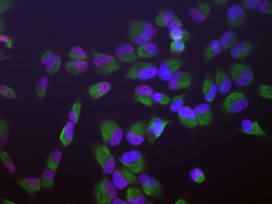 Immunofluorescence of HeLa cells showing strong granular nuclear staining of SAP49 (red, 1:1000) and vimentin (cat. 2105-VIM, green, 1:10,000). The blue is DAPI staining nuclear DNA.
