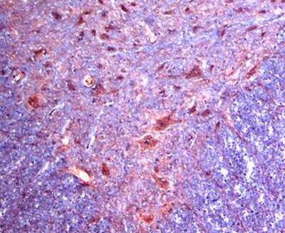 Immunohistochemistry of rat ventral spinal cord showing specific staining of Alpha 2c Adrenergic Receptor. 