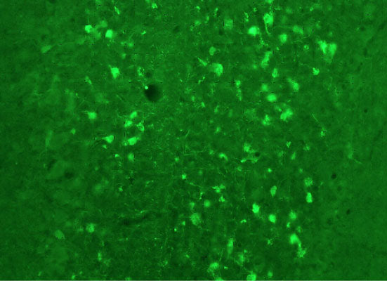 Immunostaining of rat cerebellum showing fluorescence of calretinin (cat. 303-CAL, green, 1:500) containing cells. 