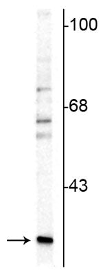 Western blot of rat cerebellar lysate showing specific immunolabeling of the ~29 kDa calretinin protein. 