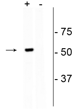 Western blot of GFP-Cas9 transfected HEK293 cell lysate (+) showing specific immunolabeling of the ~53 kDa GFP-Cas9 fusion protein. Labeling is absent in the untransfected lysate (-).