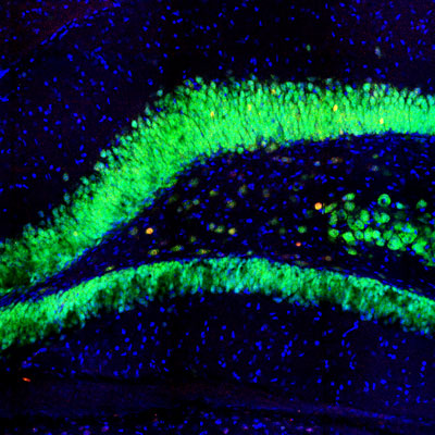 Immunofluorescence of a section of rat hippocampus showing neurons labeled with c-FOS (cat. 309-cFOS, 1:1000, red) counterstained with FOX3(NeuN) (green), and nuclear staining with DAPI. When both c-FOS and FOX3 are expressed the label appears orange. 