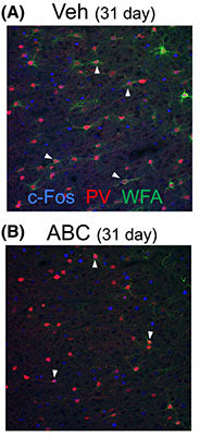(A, B) confocal microscope images showing PV, WFA, and c-Fos (cat. 309-cFOS) staining after vehicle or ABC treatment in the prelimbic PFC after vehicle or ABC 31 days later. White arrows indicate triple-labelled cells. Note faint staining of PNNs after ABC treatment. Image from publication CC-BY-4.0. PMID: 37855072.
