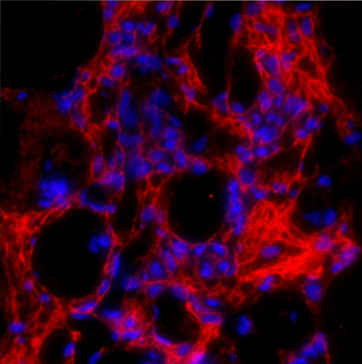 Immunostaining of formaldehyde-fixed fibrotic mouse lung tissue. The antibody recognizes mature collagen I (cat. 322-COLT, 1:100, red) that has formed fibrils in the extracellular matrix. The blue is staining nuclear DNA.