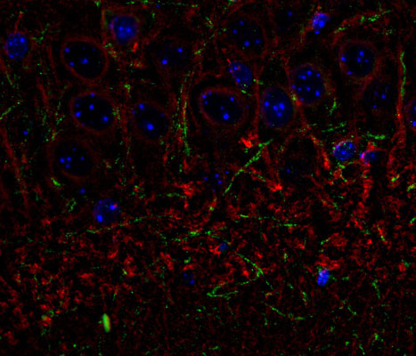 Immunolabelling of the CA3 subfield of mouse hippocampus labeling CNP (cat. 325-CNP, green, 1:500) and β-III tubulin(cat. 2020-TUB, 1:1000, red). The blue is DAPI staining DNA. Original magnification is 40X. Photo courtesy Rob Wine. 