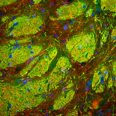Immunostaining of mouse striatum showing specific labeling of CNP in myelinating oligodendrocytes (Cat.