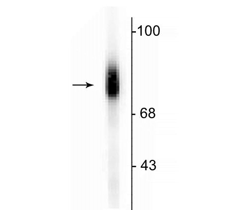 Western blot of human adrenal medulla lysate showing specific immunolabeling of the ~75 kDa DBH protein.