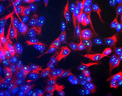Immunofluorescence of human neuroblastoma SH-SY5Y cells showing strong, prominent labeling of the nucleoli in the nucleus with Anti-Fibrillarin (cat. 560-FIB, 1:500, green), and nuclear staining was done with DAPI (blue) which makes the fibrillarin marker appear pale blue.
