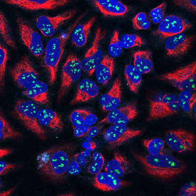 High magnification confocal image of HeLa cells showing strong, prominent labeling of the nucleoli in the nucleus with Anti-Fibrillarin (cat.  560-FIB, 1:100, green), colabeled with Anti-Vimentin (cat. 2105-VIM, red, 1:1000) showing the cytoplasmic intermediated filaments, and nuclear staining was done with DAPI (blue).