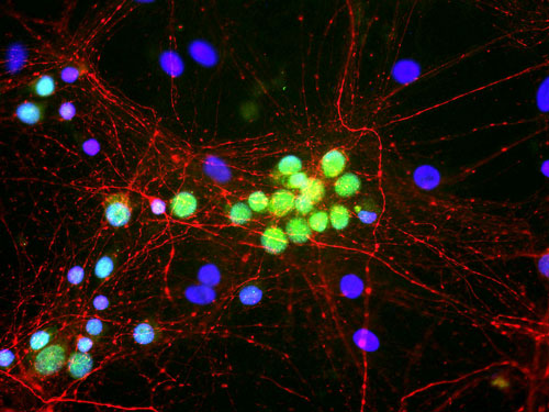 Immunofluorescence of cultured rat neurons showing nuclear and distal cytoplasmic labeling of FOX1 (cat. 581-FOX1, 1:500, green).