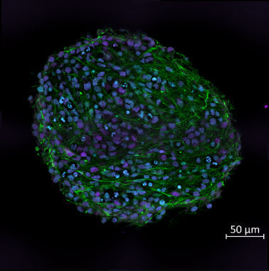 Cell Line: human-derived iPSC cerebral organoids. Neurofilament-H (green), NeuN (purple), DAPI (turquoise). Image courtesy of Caroline Krall, Johns Hopkins University