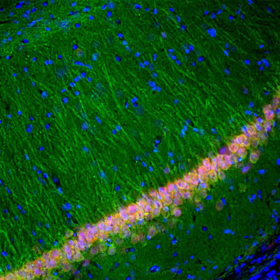 Immunofluorescence of a section of rat hippocampus showing specific labeling of UCHL1 (cat. 2060-UCHL1, 1:5000, green) in cell bodies and dendrites of neurons, and specific labeling of FOX3 (red). The blue is DAPI staining of nuclear DNA.
