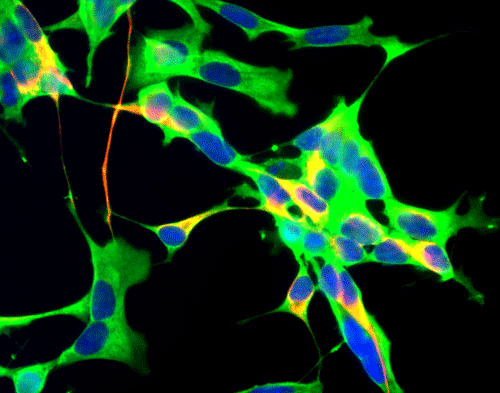 Immunostaining of Human neuroblastoma SH-SY5Y cells labeled with Anti-GAPDH(cat.  600-GAPDH, 1:100, green), Anti NF-H( cat. 1451-NFH , red, 1:25,000) and nuclear staining with DAPI (blue).
