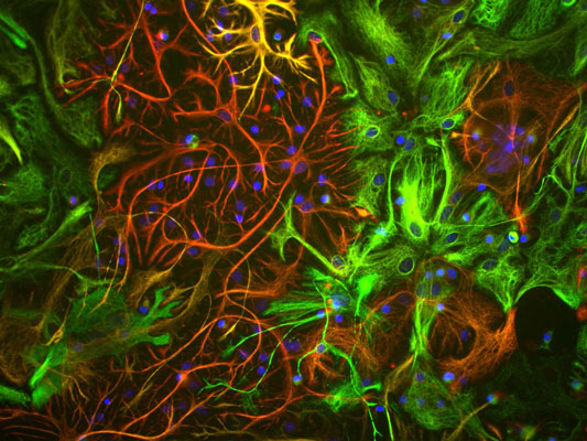 Mixed neuron/glial cultures stained with anti-vimentin (green, 1:500) and rabbit anti-GFAP antibody (cat. 620-GFAP, red, 1:1000). The blue stains nuclear DNA. Vimentin is expressed alone in fibroblastic and endothelial cells, which are the flattened cells in the middle of the image which appear green. Astrocytes may express primarily GFAP, or GFAP and vimentin, and so appear red (GFAP only) or golden yellow (GFAP and Vimentin).