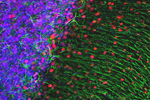 Immunofluorescence of a section of rat cerebellum labeled with anti-GFAP (cat. 620-GFAP, 1:5000,green), colabeled with anti-MeCP2 (cat. 1205-MeCP2, 1:500, red), and DAPI staining of nuclear DNA. The anti-GFAP labels the astrocytic cells and the processes of Bergmann glia in the molecular layer.