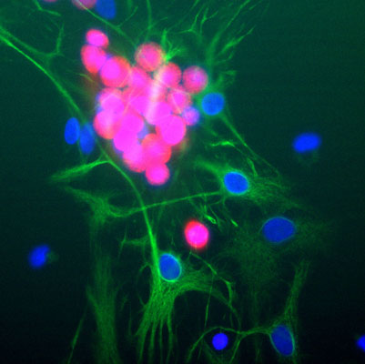 Immunolabeling of cultured rat neurons showing strong nuclear and distal cytoplasmic labeling with anti-FOX3(cat. 583-FOX3, 1:1000, red). The complete absence of astrocyte staining is shown using anti-GFAP (cat. 621-GFAP, 1:1000, green) and nuclear staining was done with DAPI (blue).