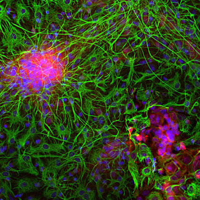 Immunolabeling of E20 rat mixed neuron and glial cultured cells labeled with anti-neuron specific enolase antibody (cat. 1520-NSE, red, 1:500) and anti-GFAP antibody (cat. 621-GFAP, green, 1:5000). The blue is Hoechst stain of nuclear DNA. Anti-NSE labels protein expressed in neuronal cells and anti-GFAP labels protein expressed in intermediate filaments in astrocytic and other glial cells. 