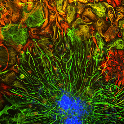 Immunostaining of E20 rat cortical neuron/glial cell culture stained with anti-vimentin (cat. 2107-VIM, red, 1:2000) and anti-GFAP antibody (cat. 621-GFAP, green, 1:5000). The blue is DAPI staining nuclear DNA. Vimentin is expressed alone in fibroblastic and developing cells and appear red. The astrocytes that appear red express only GFAP, while the golden yellow and yellow astrocytes express GFAP and Vimentin.