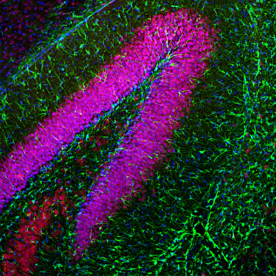 Immunofluorescence of a section of mouse hippocampus colabeled with Anti-GFAP(cat. 621-GFAP, green, 1:5000) and Anti-FOX3 (red). The Anti-FOX3 labels the nuclei and proximal perikarya of neurons while the Anti-GFAP labels a network of astroglial cells. The blue is DAPI staining of nuclear DNA.
