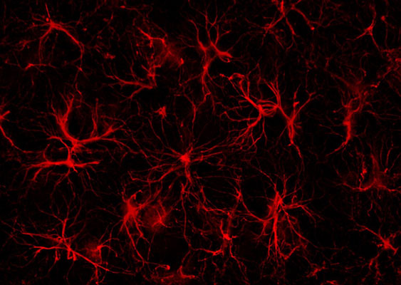 Immunofluorescence of a section of mouse prefrontal cortex labeled with Anti-GFAP(cat. 621-GFAP, red, 1:1000). Image courtesy Andrea Cardenas, Rosalind Franklin Unversity, Medicine and Science.