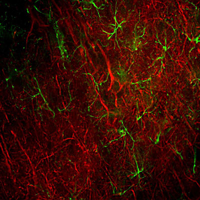 Immunofluorescence of a section of rat frontal cortex showing labeling of Neurofilament-L (cat. 1452-NFL, 1:500, red) and labeling of GFAP( cat. 621-GFAP , 1:5000, green). The anti-NFL antibody labels cell bodies and processes of pyramidal neurons, as well as dendrites and axons of other neuronal cells. While the anti-GFAP antibody labels the network of glial cells. 