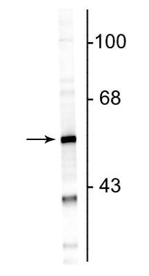 Western blot of rat cortical lysate showing specific immunolabeling of the ~50 kDa GFAP protein.