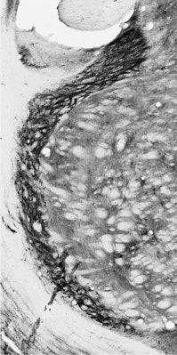Adult rat reticular thalamic nucleus immunohistochemistry.