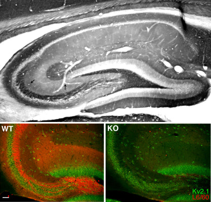 Top: Adult rat hippocampus immunohistochemistry. Bottom: Immunofluorescence staining of hippocampal CA3 of adult WT and Slo1 KO mice with L6/60 (red) and Kv2.1 rabbit polyclonal (green).