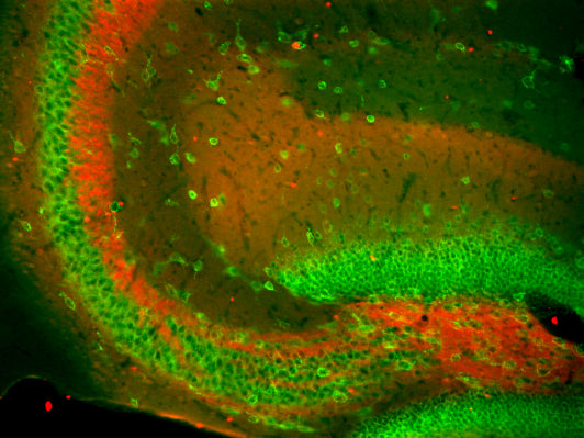 Immunofluorescence staining of hippocampal CA3 of adult WT and Slo1 KO mice with L6/60 (red) and Kv2.1 rabbit polyclonal (green).
