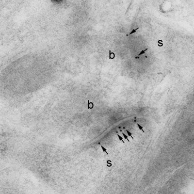 Electron micrograph of K28/43 hippocampal labelling using a post-embedding immunogold method. Immunoparticles (arrows) are seen in the postsynaptic densities of dendritic spines (s) forming asymmetrical synapses with axon terminals (b). Scale bar = 200 nm. Image courtesy of Rafael Lujan (Universidad de Castilla-La Mancha).