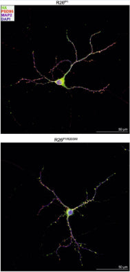 Dissociated hippocampal neurons isolated from P0 Emx1Cre:R26P1 and Emx1Cre;R26P1R203W mice were processed for confocal imaging at DIV18 to detect MAP2 (magenta), HA-tagged PACS1 or PACS1R203W (pseudocolored green), PSD95 (cat. 75-028, 1:250; pseudocolored red) and DAPI (blue). Image from publication CC-BY-4.0. PMID:37848409