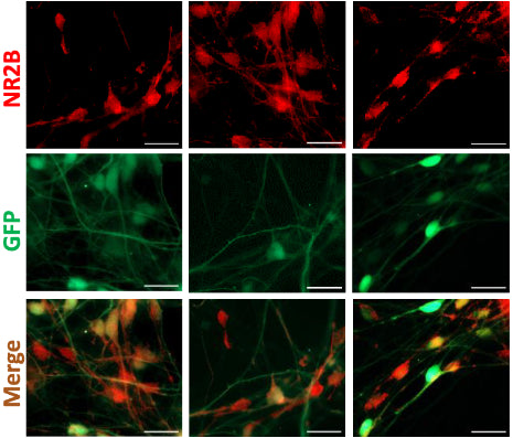 Immunostaining for GFAP, NR2B (cat. 75-101, 1:100), and TH expression indicates proper differentiation of six-week-old neuronal cultures. Image from publication CC-BY-4.0. PMID:37739965