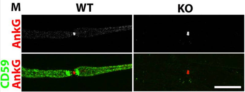 Immunofluorescence labeling of WT (left panels) and CD59 KO mouse(right panels) teased fibers show normal node structure by CD59 (green) and AnkG (cat. 75.146; red). Image from publication CC-BY-4.0. PMID:37875972