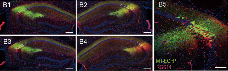 Representative confocal serial sections of mouse hippocampus infected with M1-EGFP (green) and stained with RGS14 (75-170, 1:500; red). B5 Magnified image of M1-EGFP (green) collocated with RGS14 (red) in CA2 region. Image from publication CC-BY-4.0. PMID:37303064